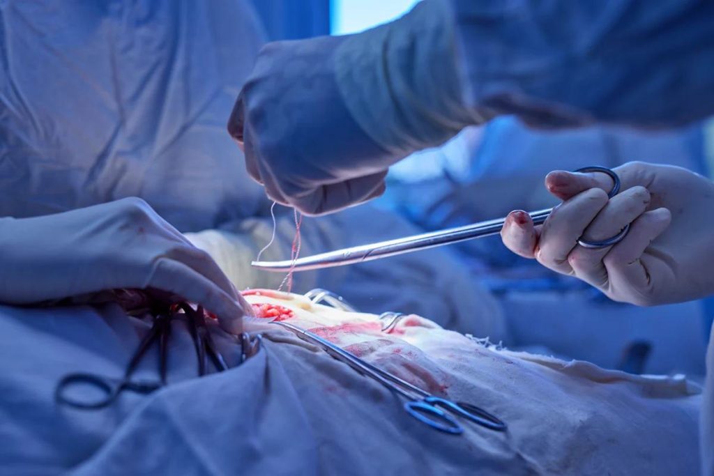 Vascular surgery being performed